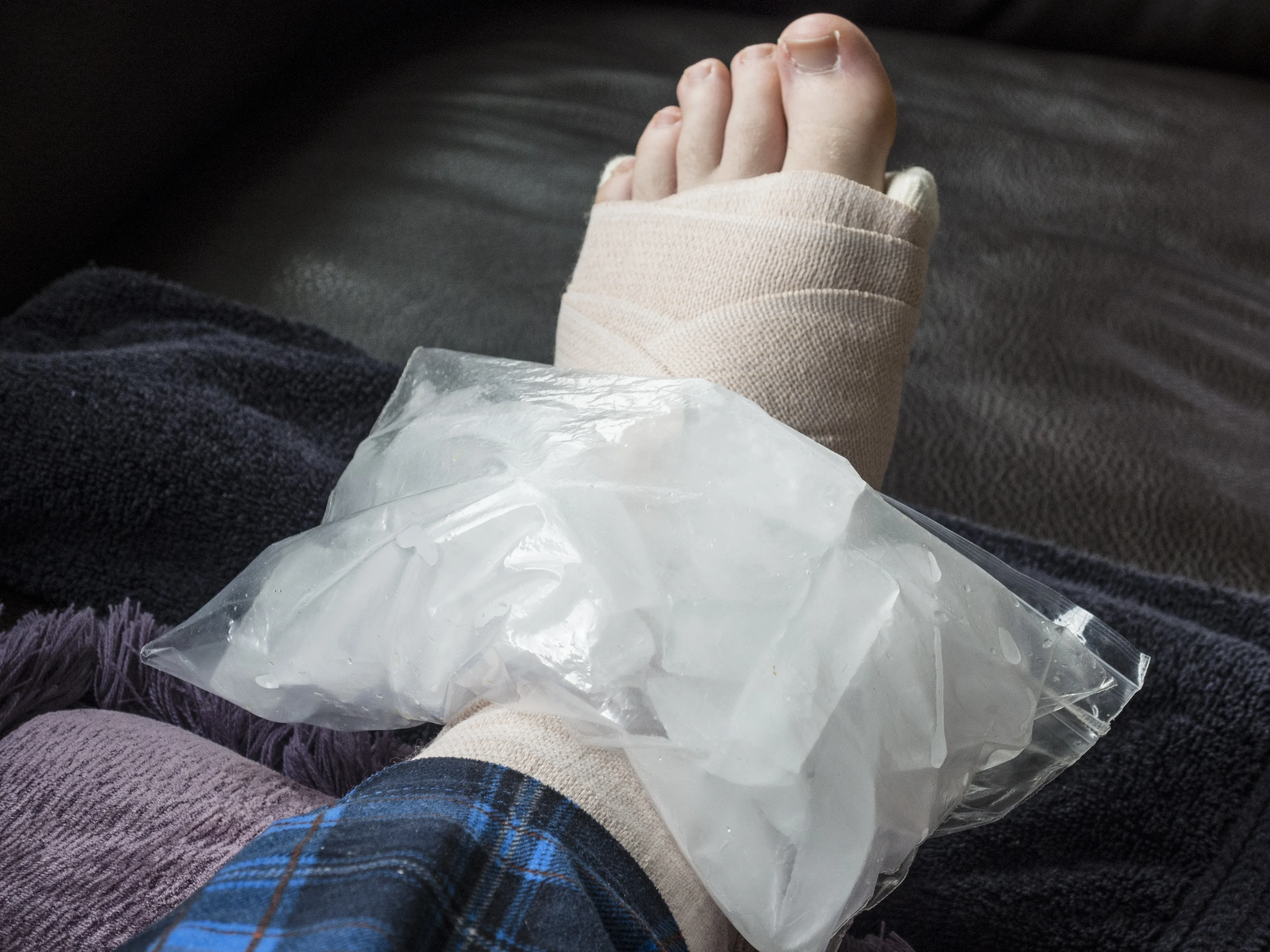 Heat vs. Ice: What to Use for Sprains, Strains, and Sore Muscles